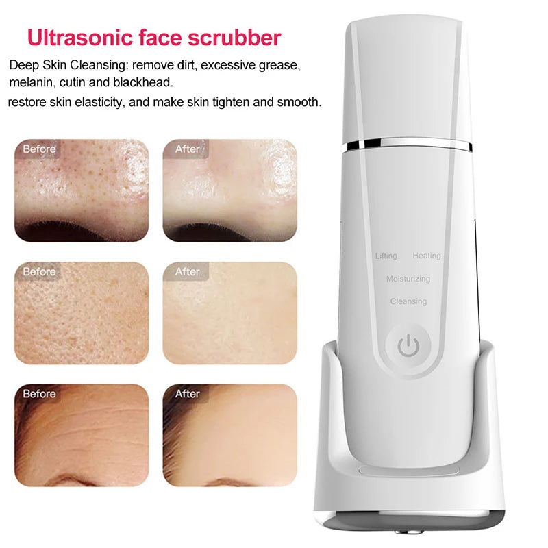 White ultrasonic face scrubber with visible before and after skin improvement results.